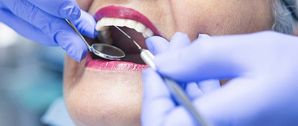Best Emergency Root Canal Treatment in Ripley, WV
